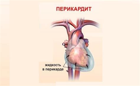 Сердечный кашель: что это такое и как его лечить, симптомы, отличия от ...