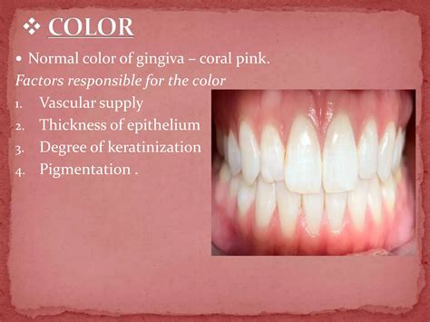 Clinical examination of gingiva | PPTX
