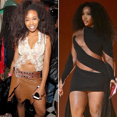 SZA Before Surgery and What She Looks Like After