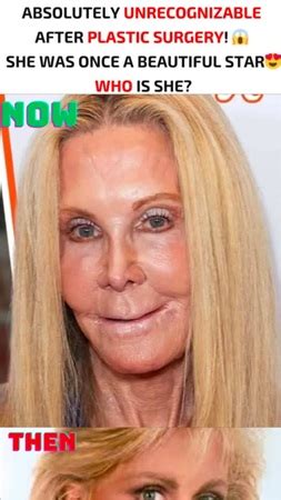 Joan Van Ark: The Trailblazing Star Who Redefined What Beauty, Legacy ...