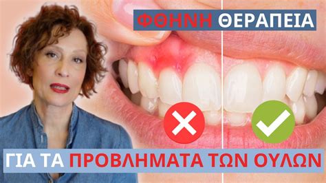 Σταματήστε την ουλίτιδα, με ΑΥΤΟ τον τρόπο! - YouTube