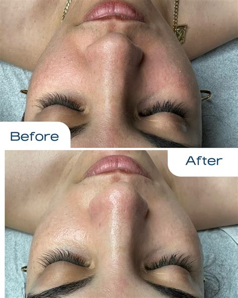 Did You Know Levisa Lazer Can Do THIS? Image 1