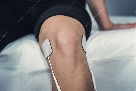 TENS therapy - Stock Image - F024/8251 - Science Photo Library