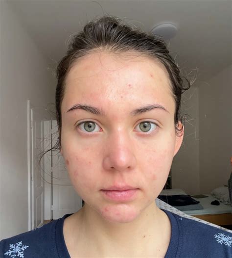 SHAANT Spot Hero – Codex Labs Corp