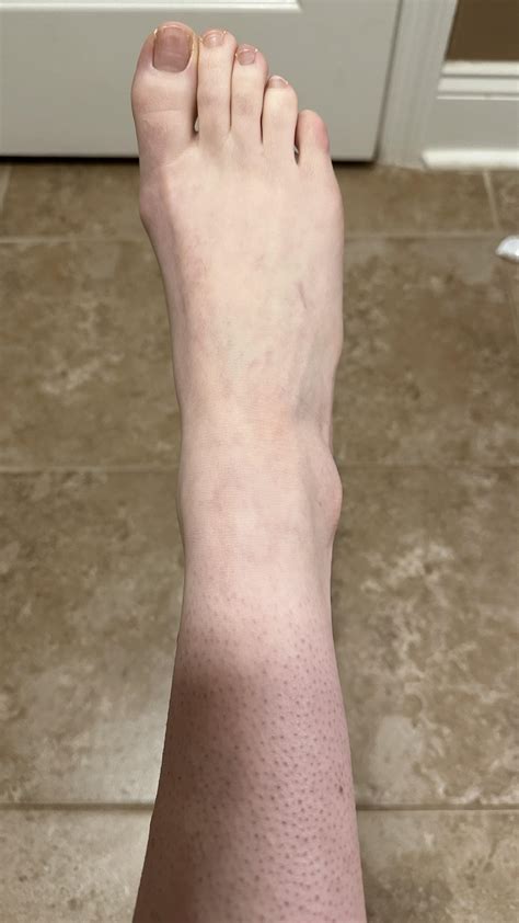 Is it Raynauds or have my feet just deceased themselves? : r/Sjogrens