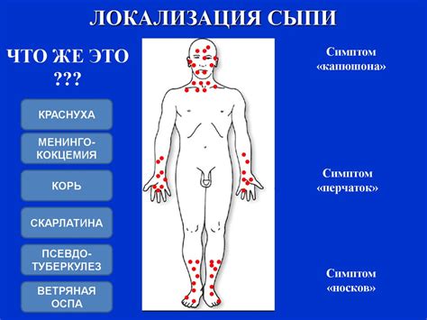 Дифференциальная диагностика заболеваний с синдромом экзантемы ...