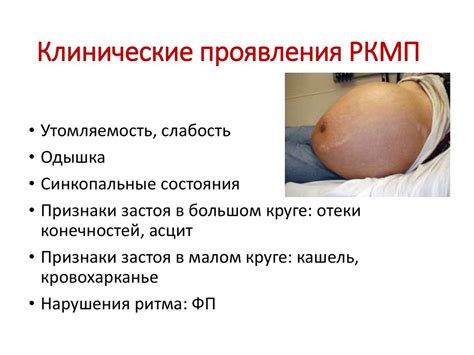 Рестриктивная кардиомиопатия - презентация онлайн