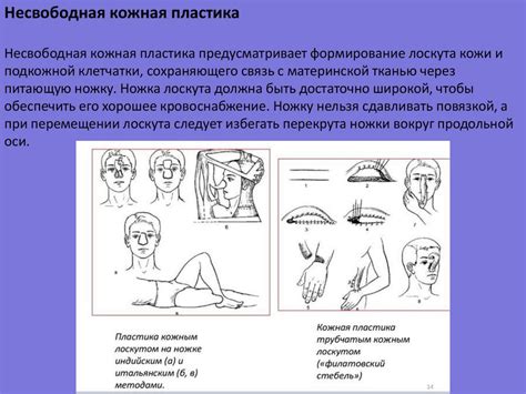 Кожная пластика - презентация онлайн