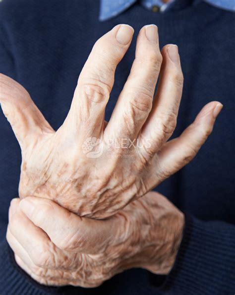 Hyderabad’s Best Rheumatoid Arthritis Treatment | Plexus