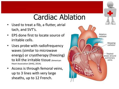 cardiac ablation system