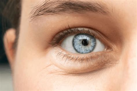 What is a cornea transplant? - Florence Healthcare International