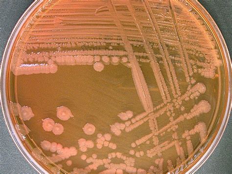 Proteus vulgaris | Microbiology, Microbiology study, Microbiology lab