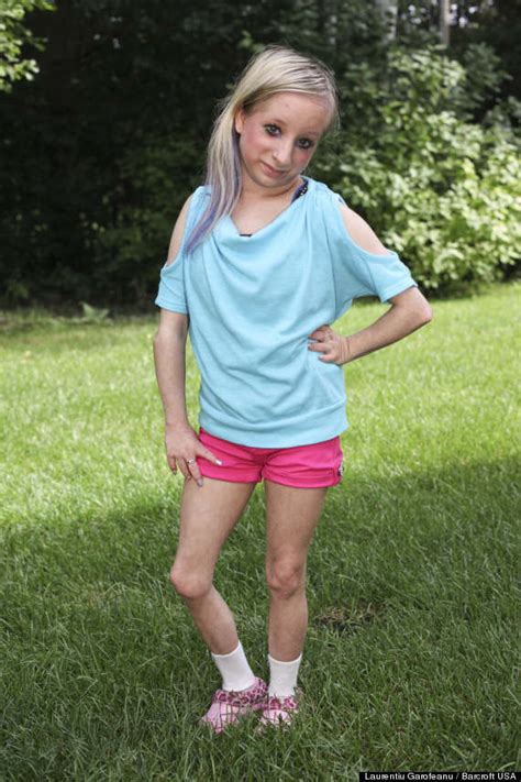 'It Doesn't Mean I'm Any Different': Teen Born With Primordial Dwarfism ...