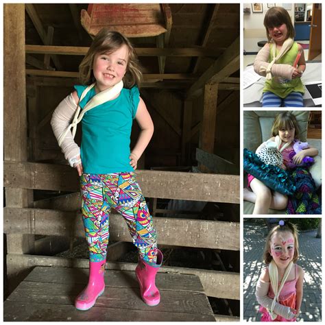 Little girl with a big cast - Lewis Center Mom