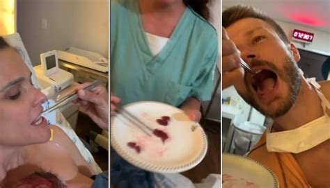 Comer A Placenta - Comer a placenta tem vantagens ou é perigoso? - Revista Crescer | Gravidez