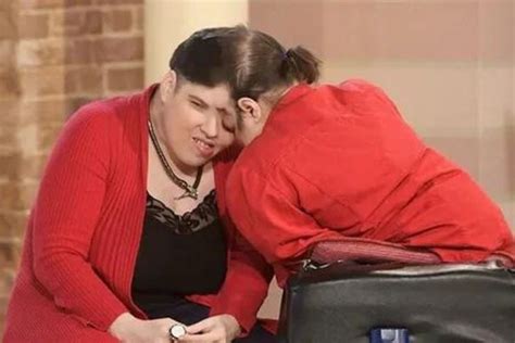 Lori and George Schappell: conjoined twins' story.