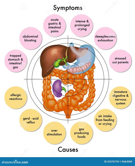 Colic stock vector. Illustration of colic, bladder, biliary - 23570739