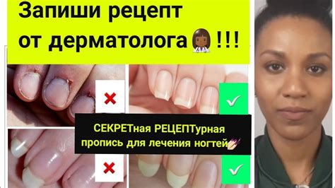 Как отрастить длинные ногти быстро//Если слоятся ногти//Ломкость ногтей ...