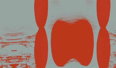 stereoscope
