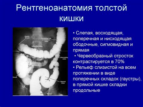 Рентгендиагностика заболеваний ЖКТ - online presentation