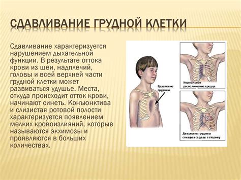 Ушибы и сотрясение, сдавление грудной клетки и - online presentation