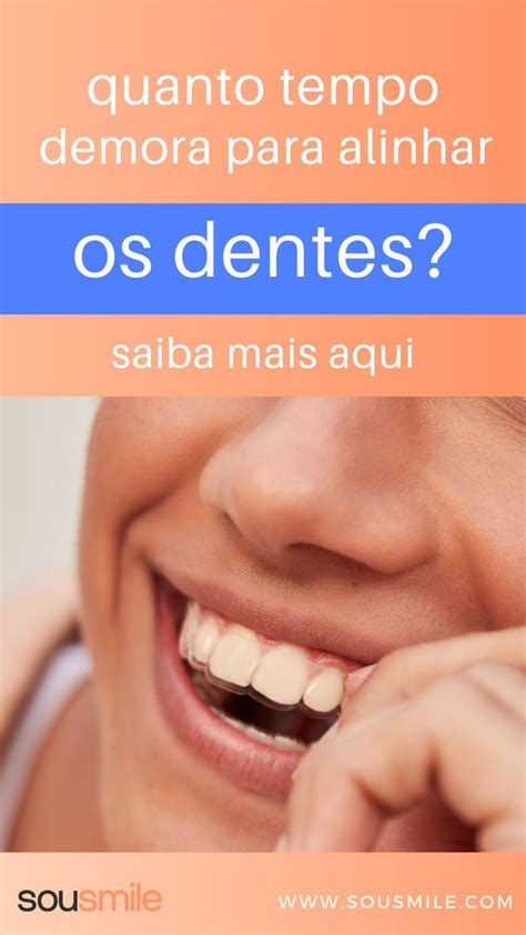 Depois Da Documentação Quanto Tempo Demora Para Colocar O Aparelho - Quanto tempo demora para alinhar os dentes – Artofit