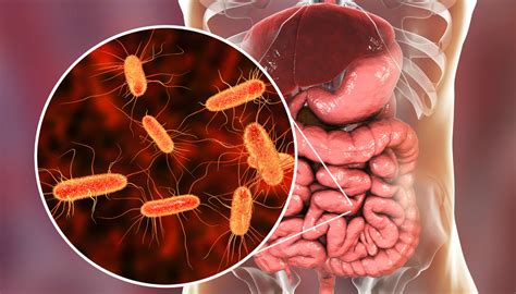 Bacteria Que Causa Diarreia - Ter diarreia tomando antibiótico é normal? Pode ser alguma coisa grave ...