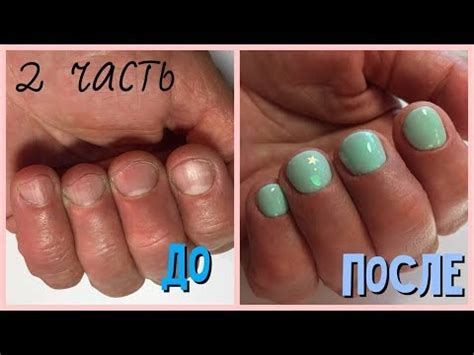 ПРЕОБРАЖЕНИЕ 2 часть| как УДЛИНИТЬ ногтевую пластину?| КОМБИНИРОВАННЫЙ ...