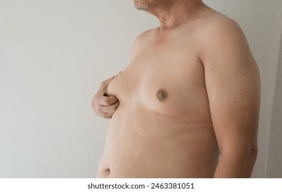 1+ Thousand Gynecomastia Royalty-Free Images, Stock Photos & Pictures