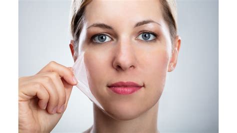 What to Expect After a Chemical Peel?