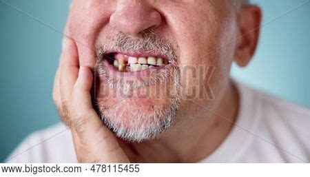 Sore Tooth Decay. Man Image & Photo (Free Trial) | Bigstock
