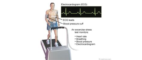 exercise stress echocardiogram  heart cardiology