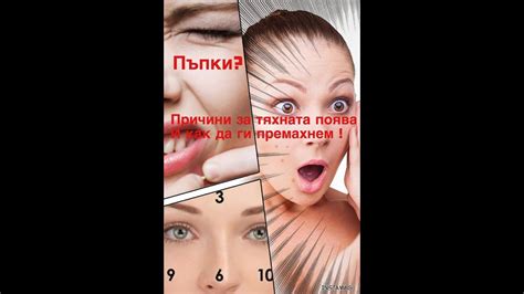 Пъпки ?! Причини,коите може би не знаете | част 1 | - YouTube