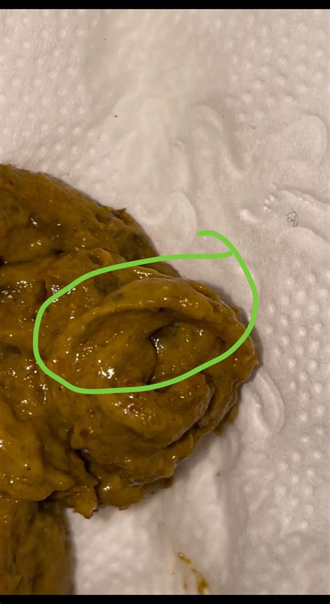 Why Is My Stool Thin And Flat at Sara Schock blog