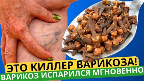 НОГИ НЕ БОЛЯТ, ПЬЮ ЭТО И ПРОШЕЛ ВАРИКОЗ И ПЕРЕСТАЛИ ОПУХАТЬ! - YouTube