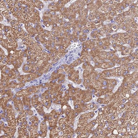MGST1 Polyclonal Antibody (PA5-60845)