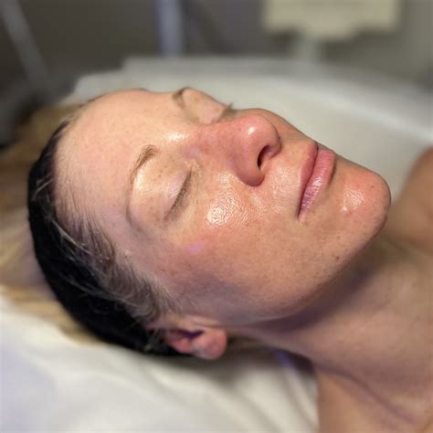 How Does A Hydrafacial Work? | Defy Aesthetic®