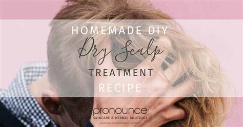 How to Treat a Dry Scalp Naturally (With 3 Soothing DIY Oil Blends ...