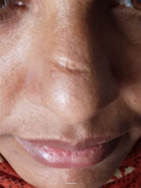 cut nose to spite face 1