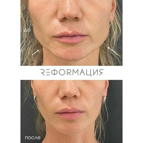 Клиника anti-age медицины Реформация