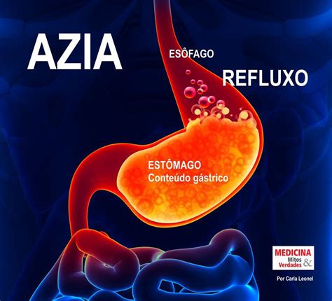 Muita Azia Pode Ser O Que