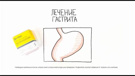 Реклама Фосфалюгель и Де-Нол - "Лечение гастрита" - YouTube