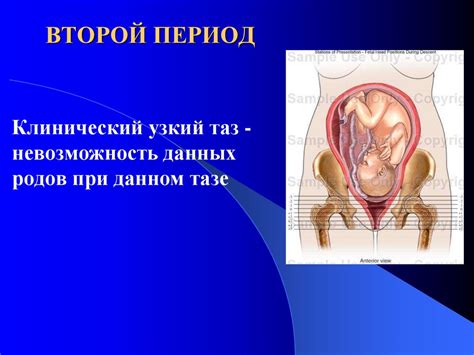 Узкий таз в современном акушерстве. (Лекция 18) - презентация онлайн