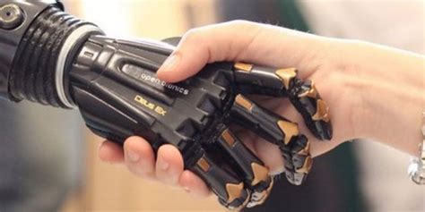 Boy, 10, to get bionic hand in time for Christmas | Fox News