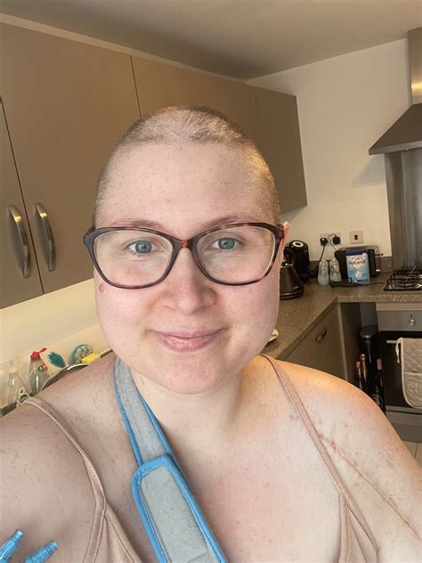 Mother’s warning after pain after pregnancy turned out to be aggressive