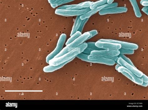 Scanning electron micrograph of tuberculosis bacteria Stock Photo - Alamy