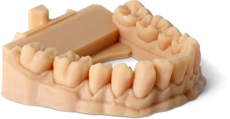 Phrozen Dental Model Resin - Water Washable - 1KG– Ultimate 3D Printing ...