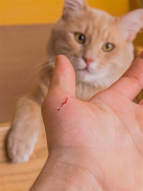 Cat Scratch Disease