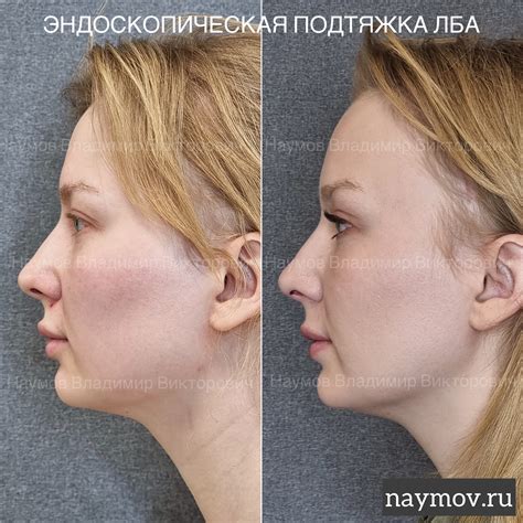 Красота на лобном месте - Косметология