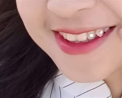 dinh da rang va nhung dieu  luu  khi thuc hien dinh da len rang